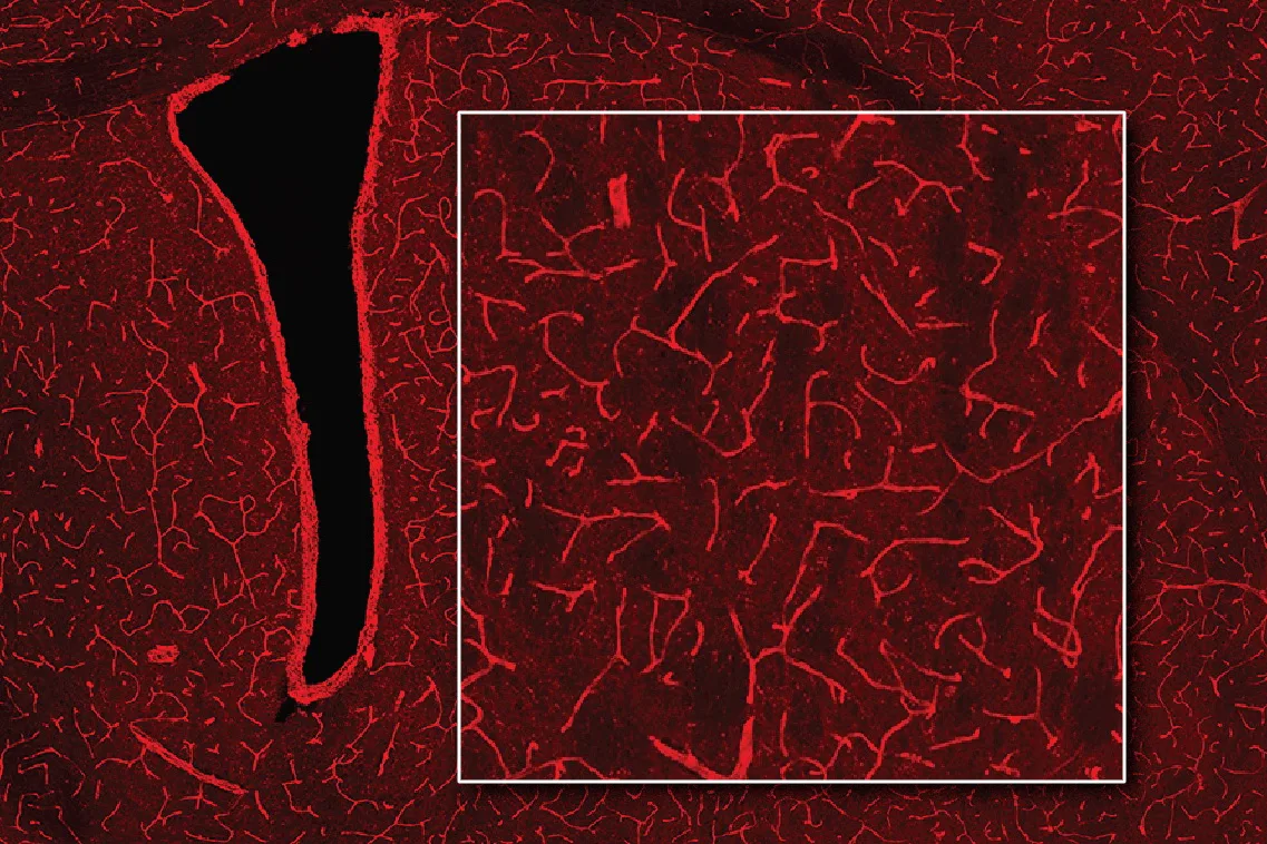 Grâce à l'IRM, des ingénieurs ont trouvé un moyen de détecter la lumière au plus profond du cerveau |  Actualités du MIT