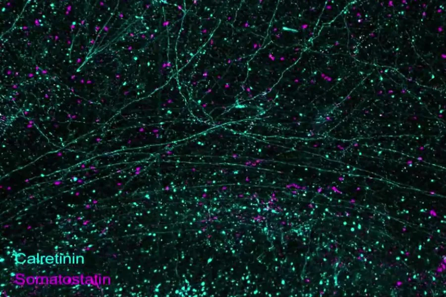 Les technologies permettent l'imagerie 3D d'hémisphères cérébraux humains entiers à une résolution subcellulaire |  Actualités du MIT