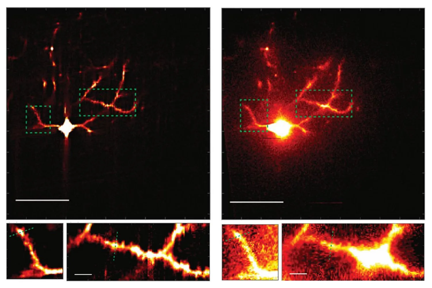 Un système de microscope affine la vision des scientifiques sur les connexions des circuits neuronaux |  Actualités du MIT